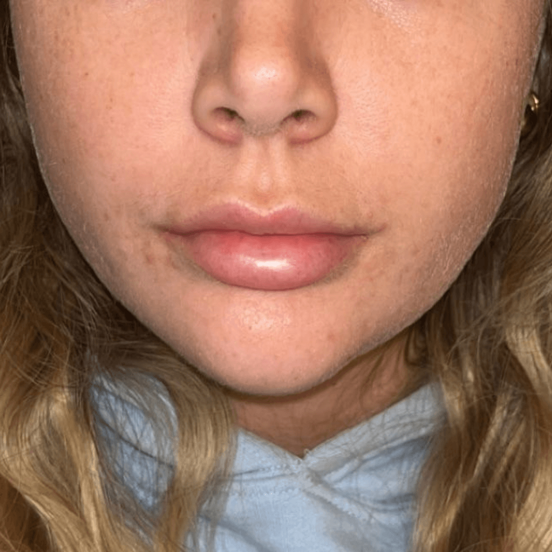 hanna-customer-after.png__PID:5ce76315-a199-4531-bd35-0ce0f2712844