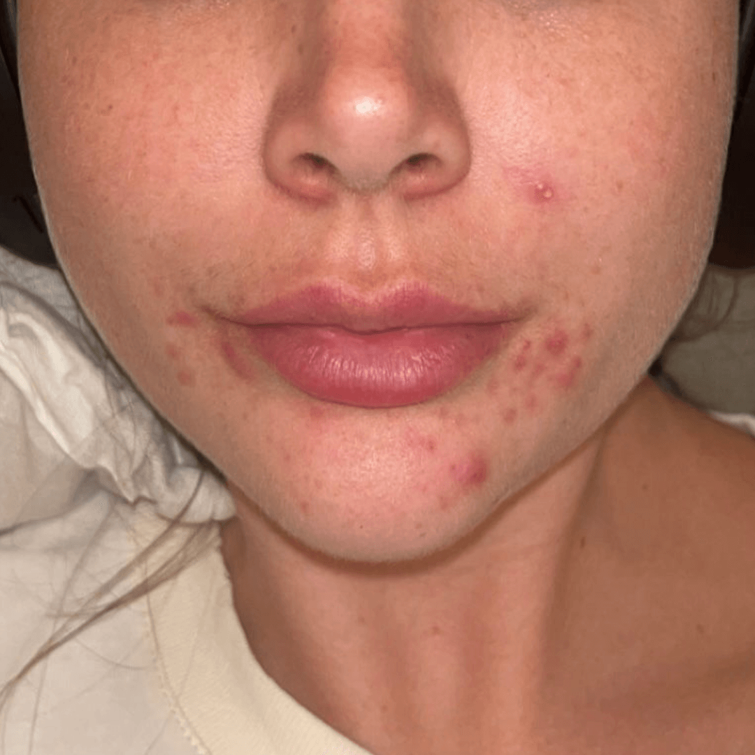 hanna-customer-before.png__PID:773c5ce7-6315-4199-a531-7d350ce0f271